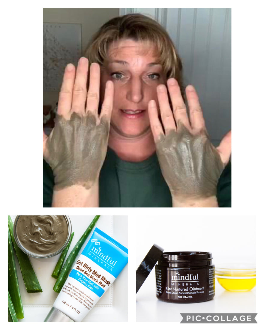 Drying, cracked skin due to so much hand washing?