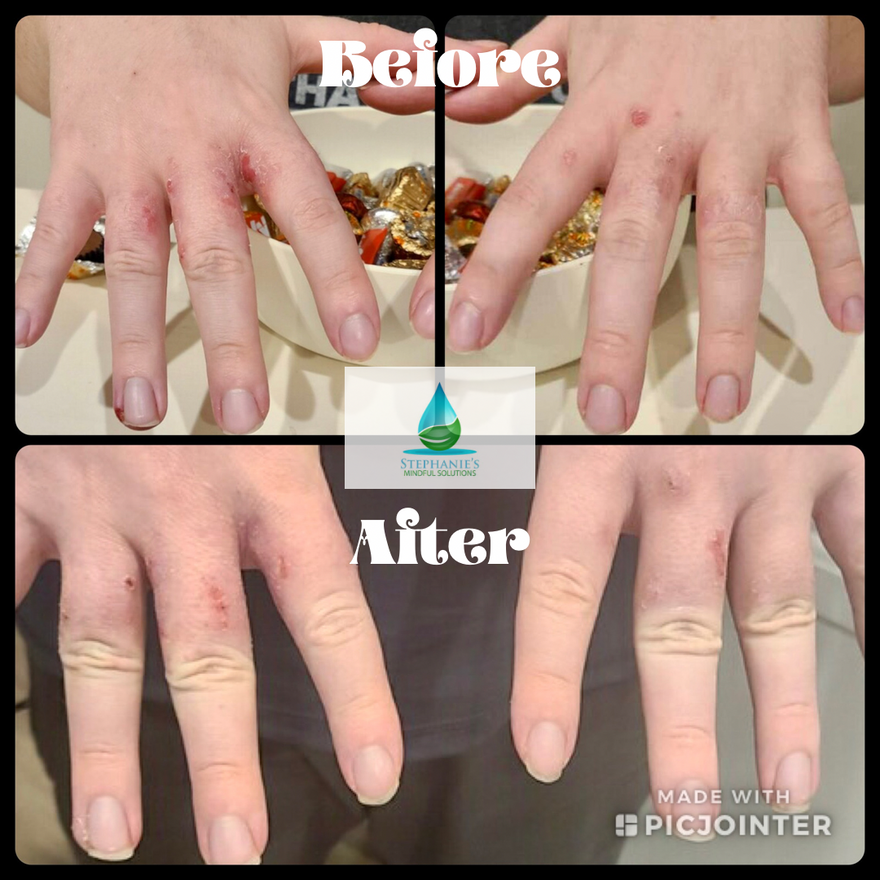 Skin relief with liquid gold