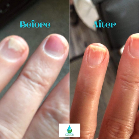 Transdermal vs Topical Products